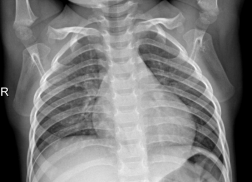 X-ray classification